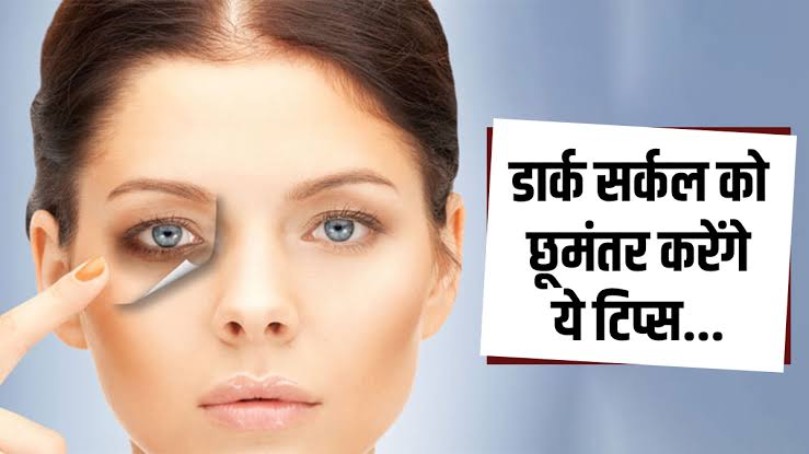 Dark Circles kaise thik kare